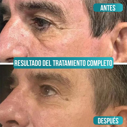 Veze Men - Poderosa Crema Antiedad para Hombres